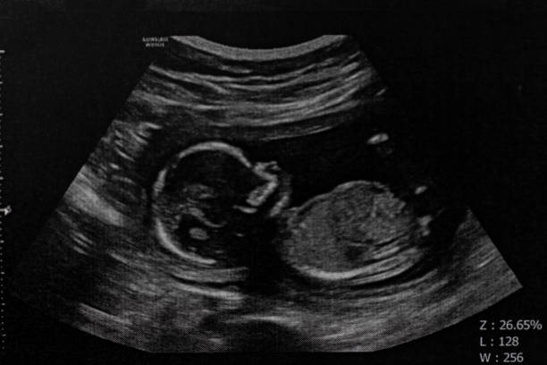 Shout out around the world the seed of affection you have in your uterus having a fake sonogram post thumbnail image